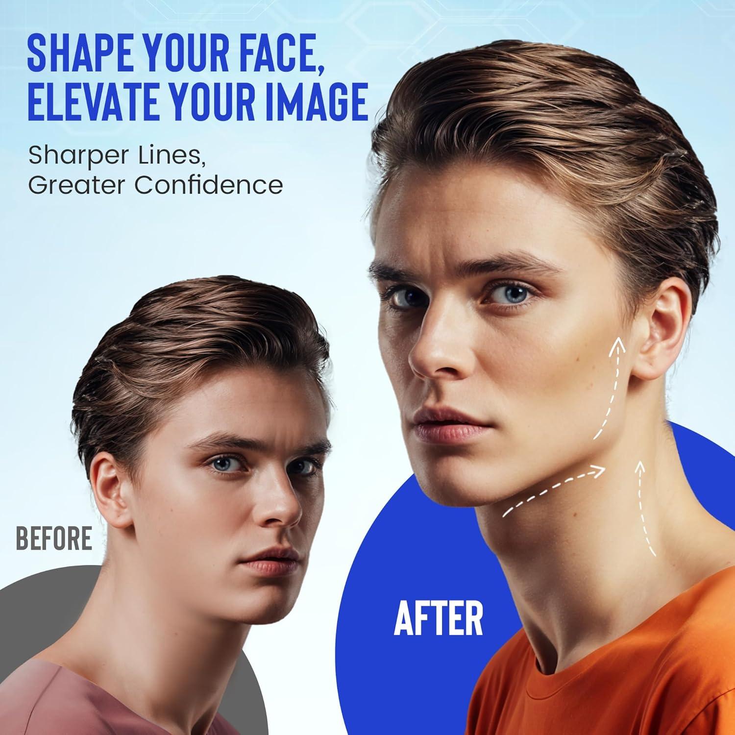 Ejercitador de mandíbula Achilles Fitness - Silicona Azul