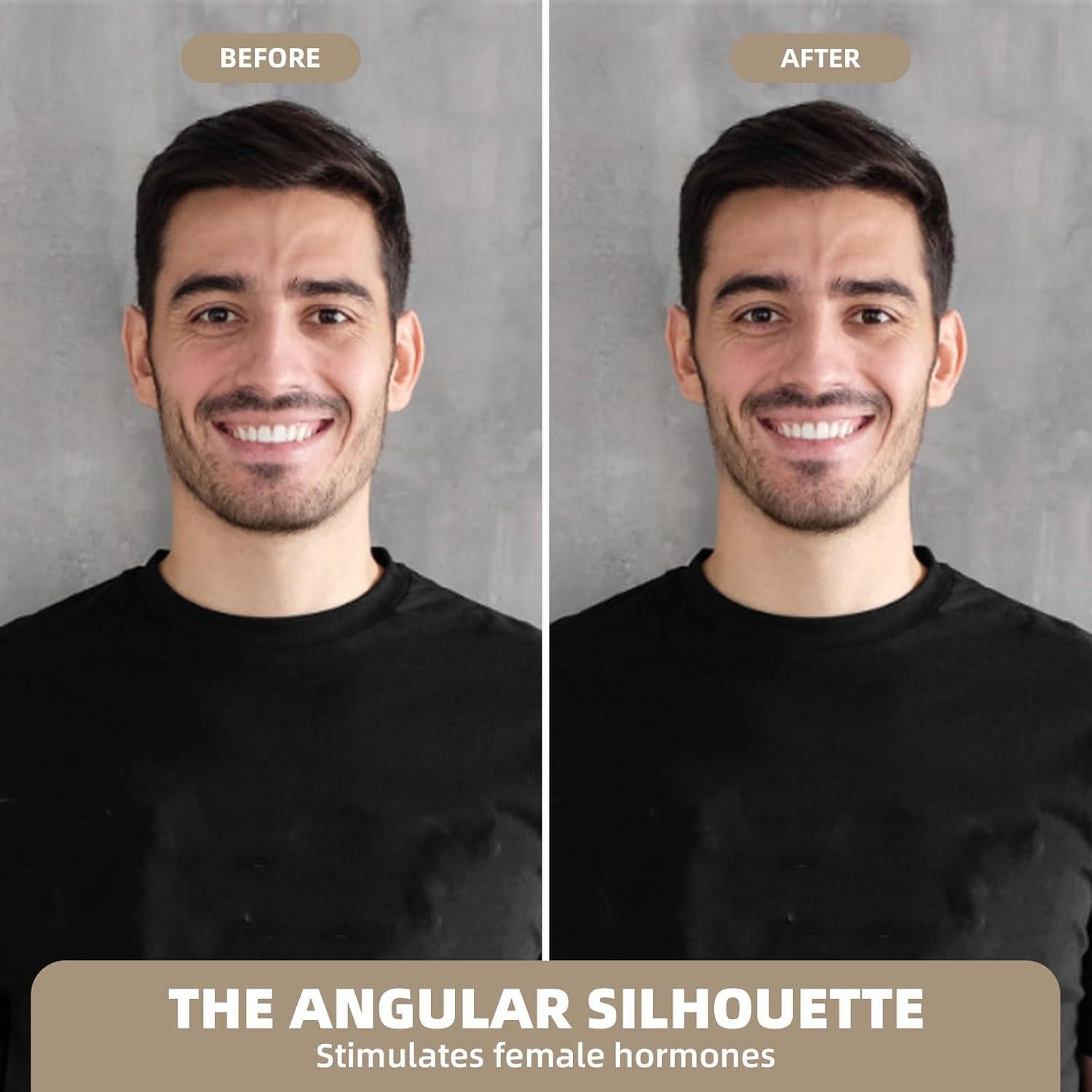 Máscara Elevadora V-Line - Reductor de Papada y Moldeador