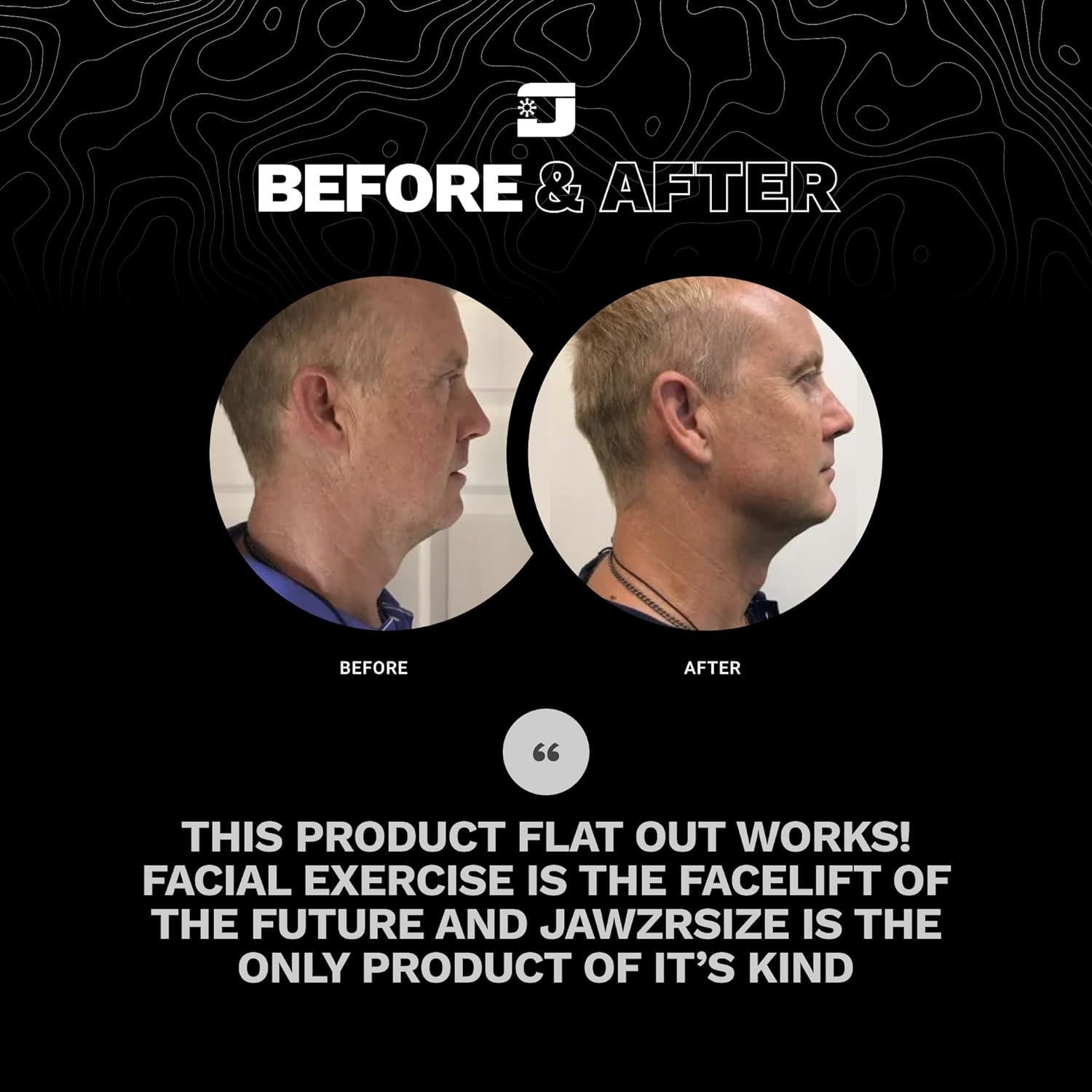 Ejercitador Facial Jawzrsize PNG Verde - Tonifica y Define