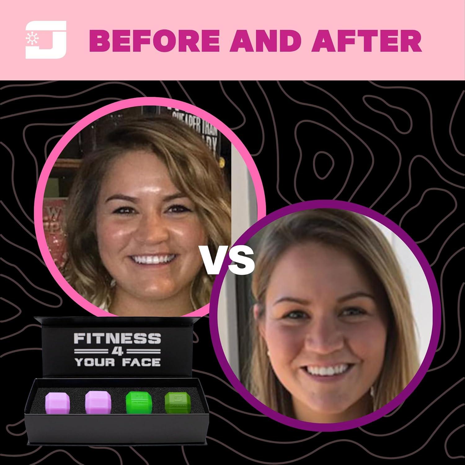 Ejercitador de Mandíbula Jawzrsize Rosa - Tonificador Facial