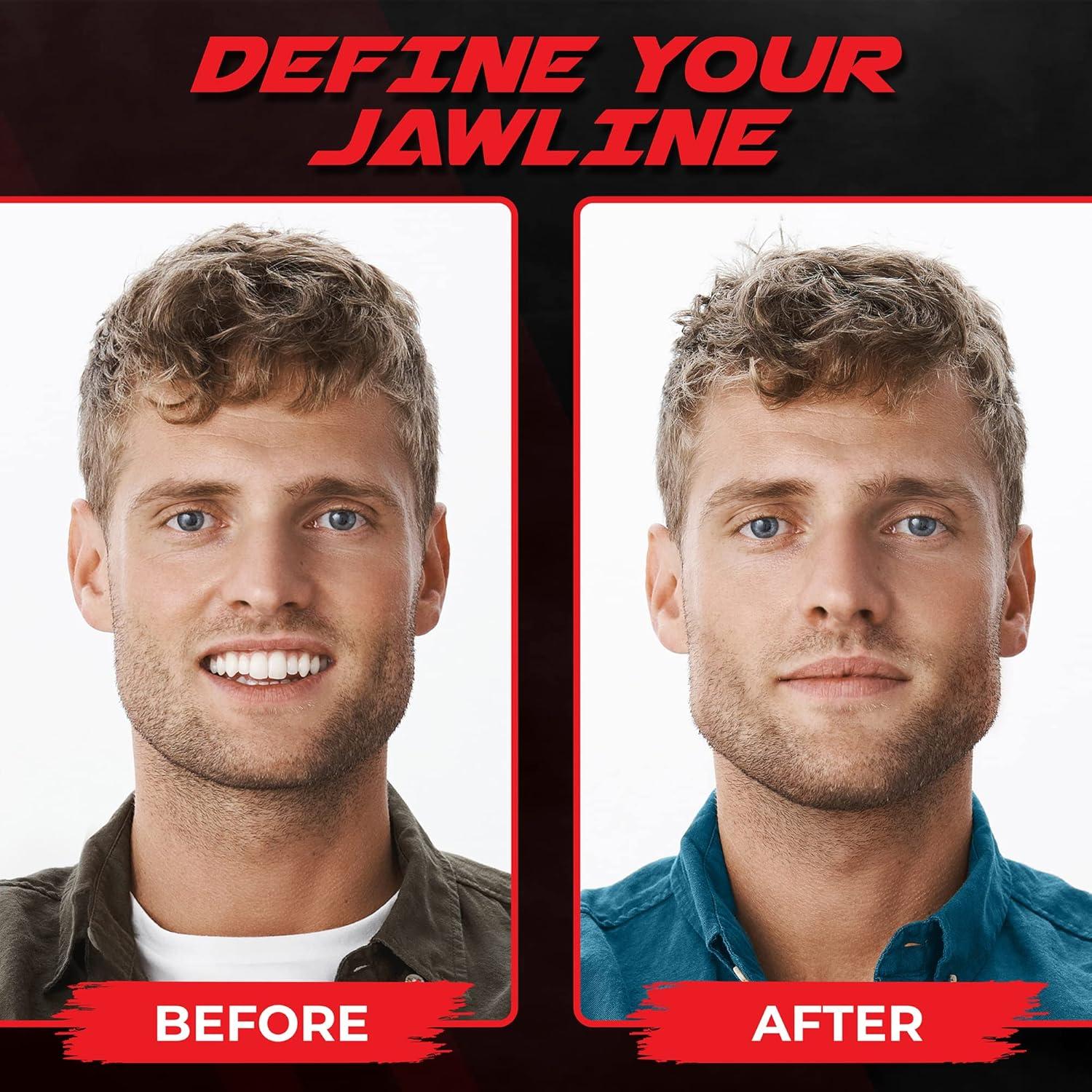 Ejercitador de Mandíbula Mayena Sports Multicolor 4 Set