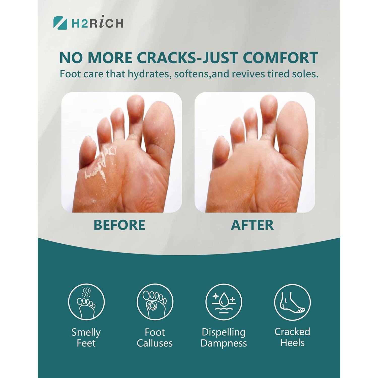 Tabletas Efervescentes H2RICH para Remojo de Pies 2 Piezas