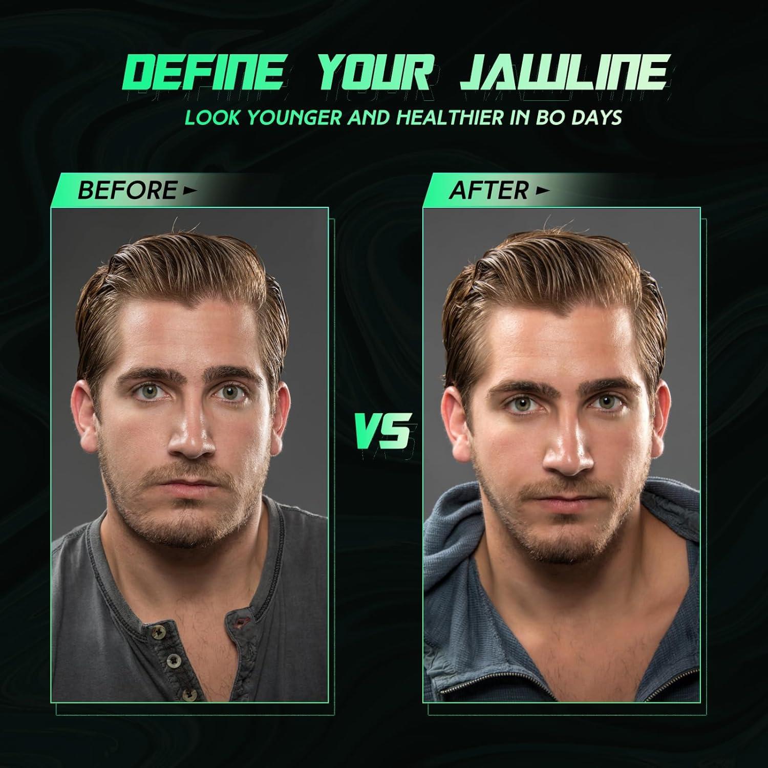 Ejercitador de Mandíbula CJing JE01-CJ Silicona 3 Niveles