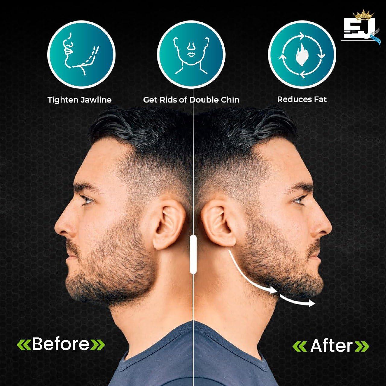 Ejercitador de Mandíbula EdJay - Tonifica y Fortalece Facial