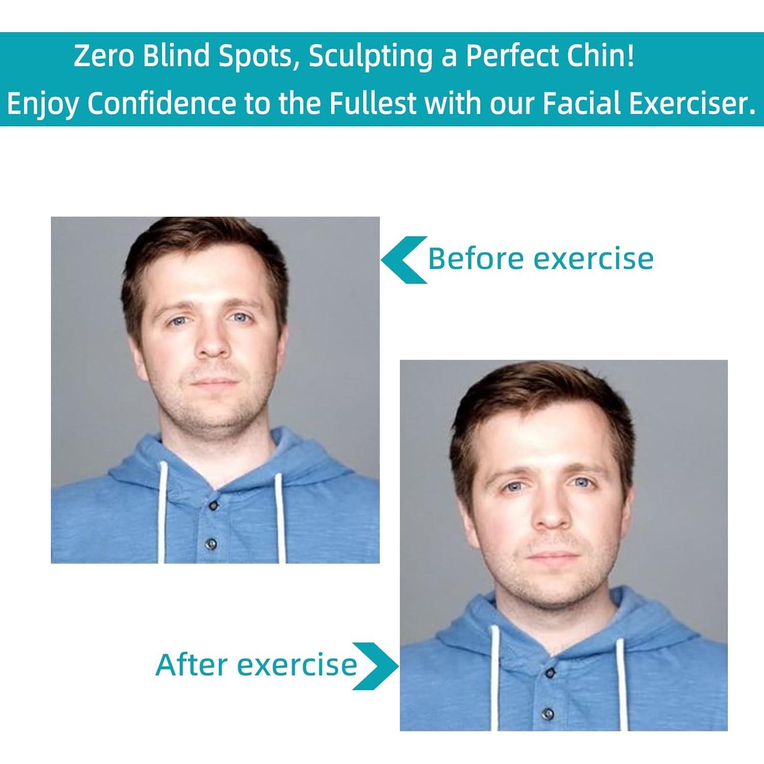 Ejercitador de Mandíbula LADYPONYCSC 3 Resistencias Ajustables