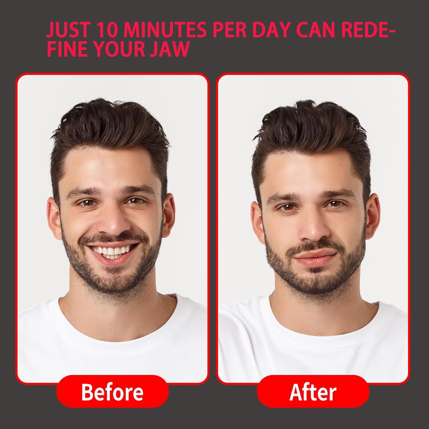 Ejercitador de Mandíbula NAYCNYCON 3 Niveles Silicona