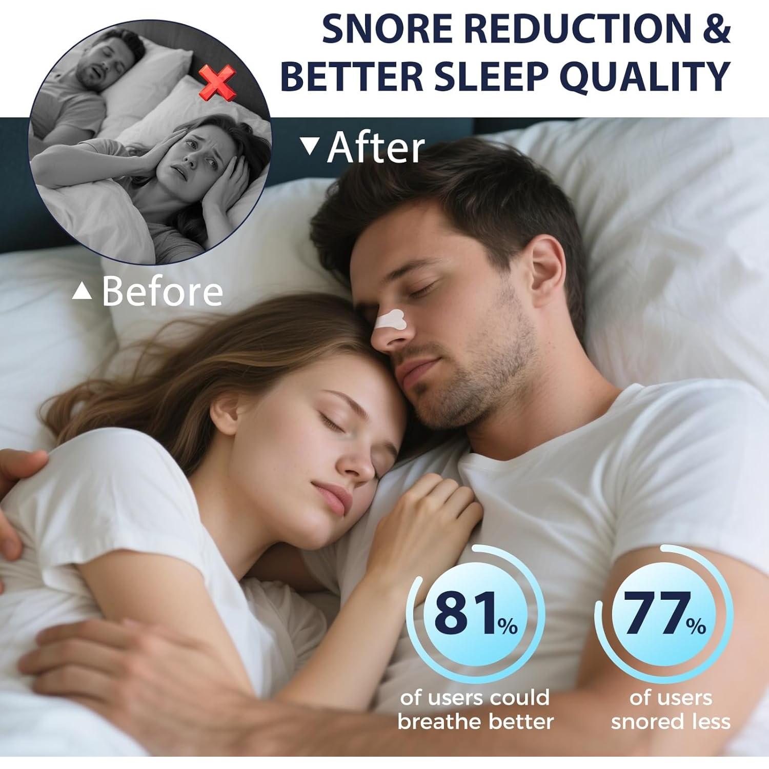 Tiras Nasales Eovvoe para Ronquidos y Respiración 30 Pzas