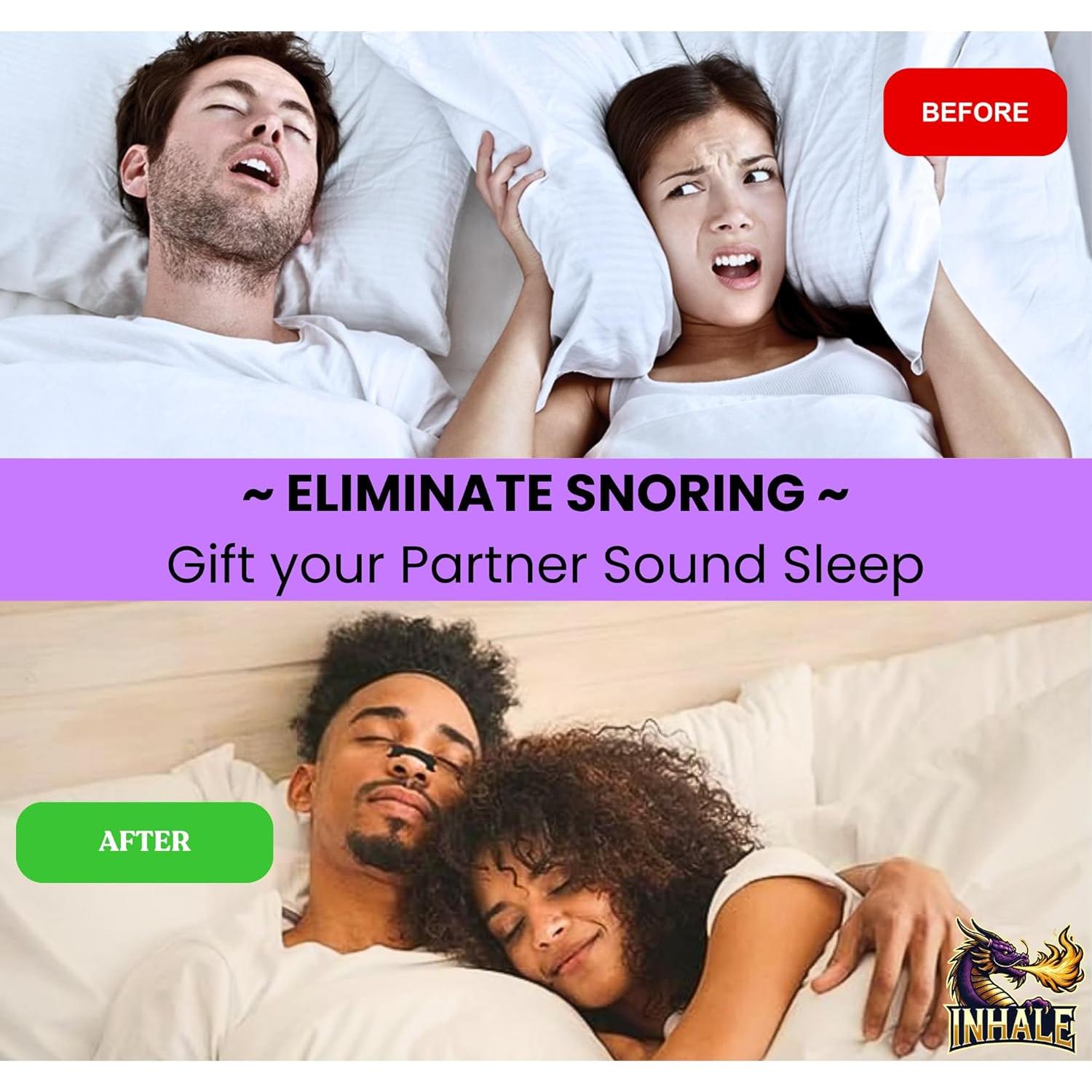 Tiras Nasales Dongguan 35 Unidades Alivio Ronquidos y Sueño