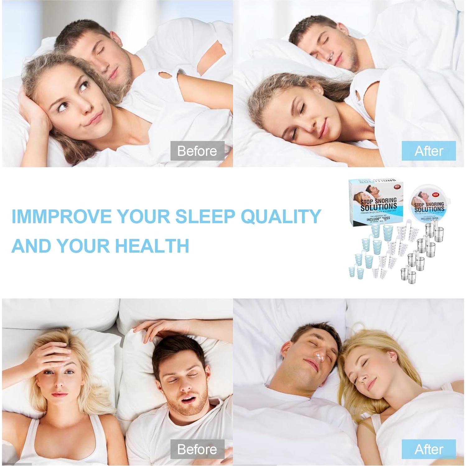 Dilatador Nasal Reutilizable MYMULIKE 4 Tamaños Antisnoring