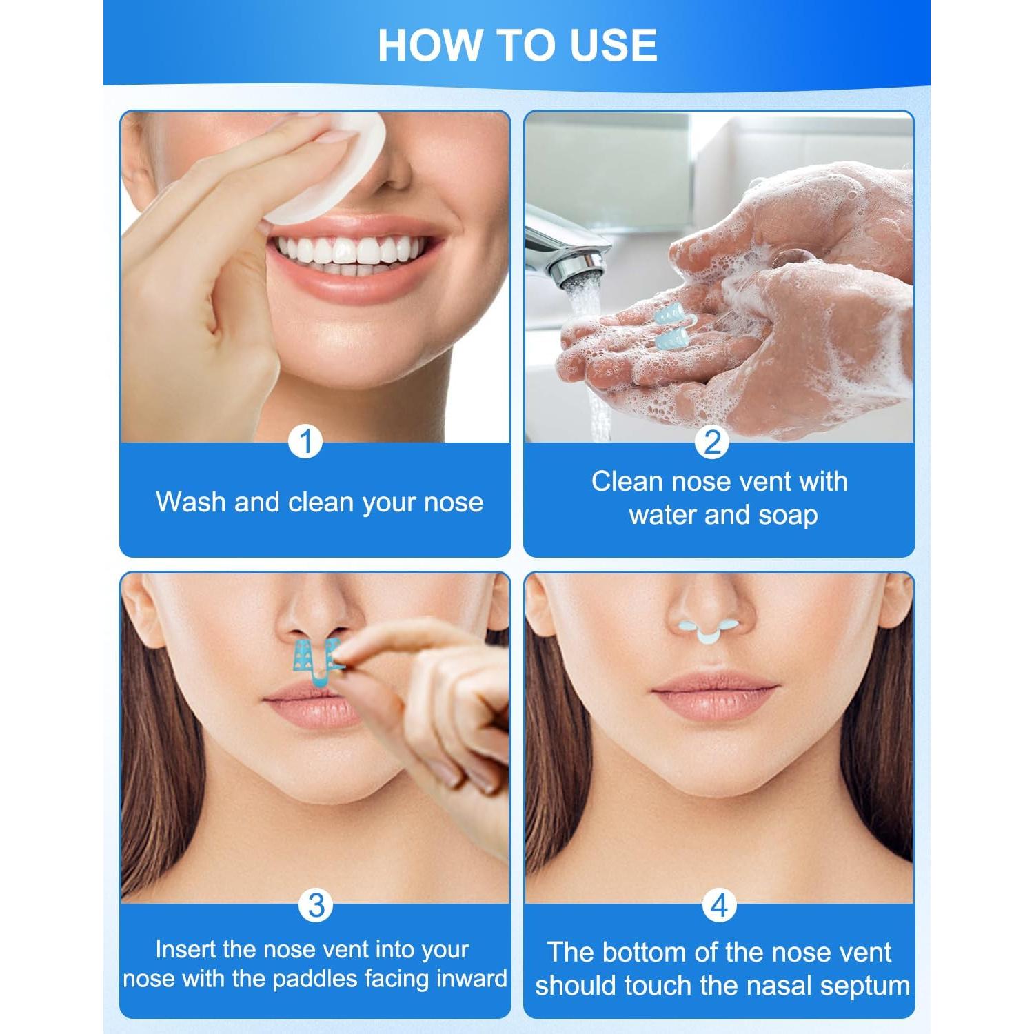 Dilatadores Nasales MQFORU 4 Tamaños Silicona Antirronquido