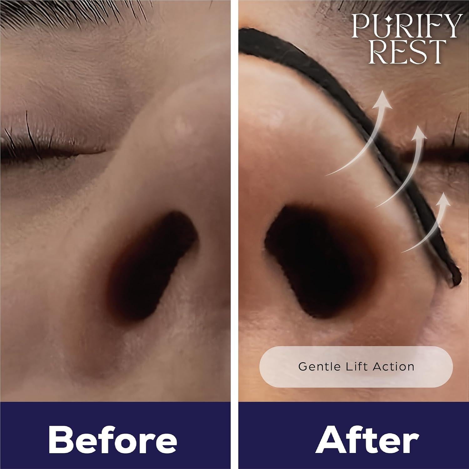 Tiras Nasales Purify Rest para Ronquidos - 50 Unidades