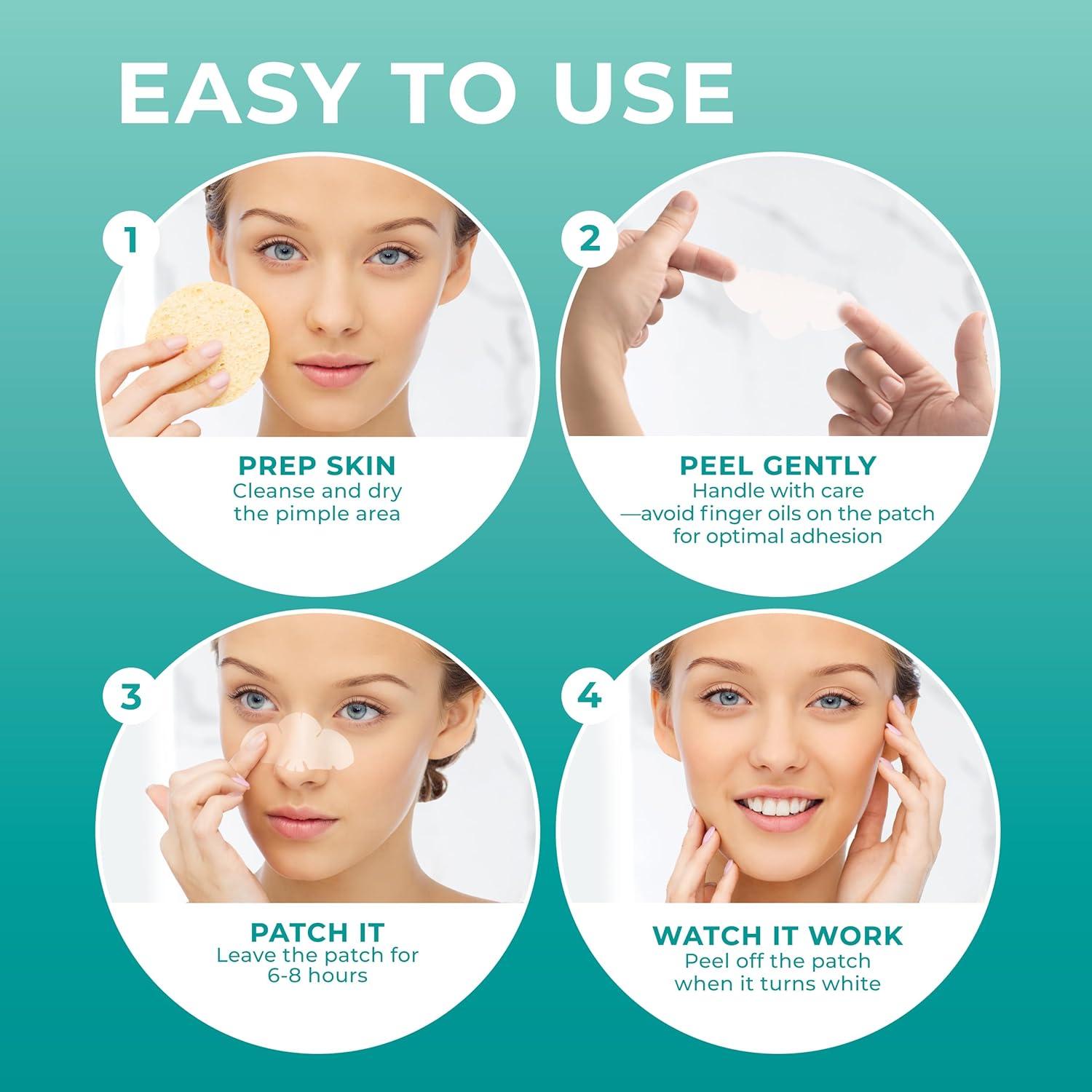 Parches para Granos PatchRx Nariz 12 Piezas Hidrocoloide