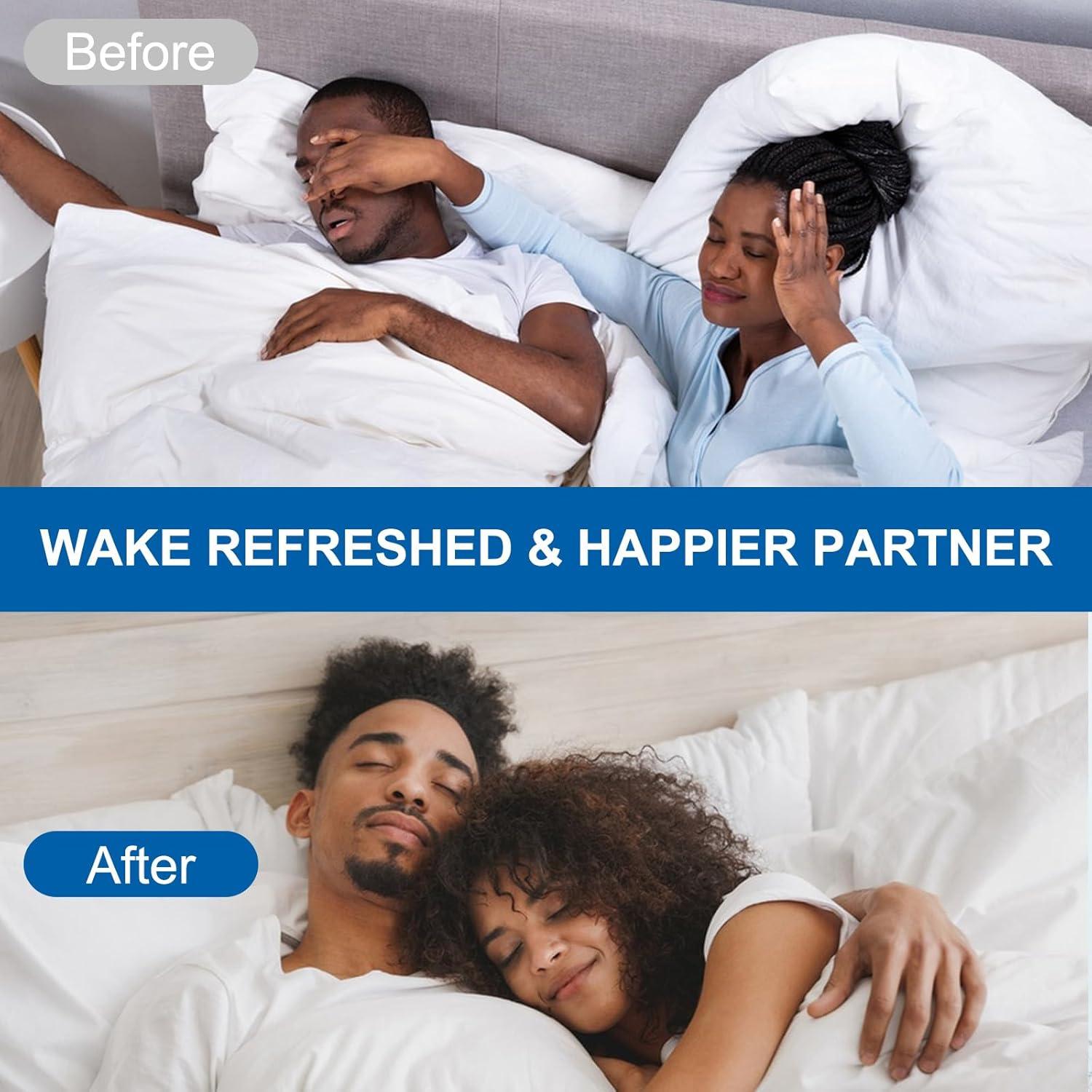 Tiras Nasales MQ Mejoradas para Ronquidos 50 Unidades