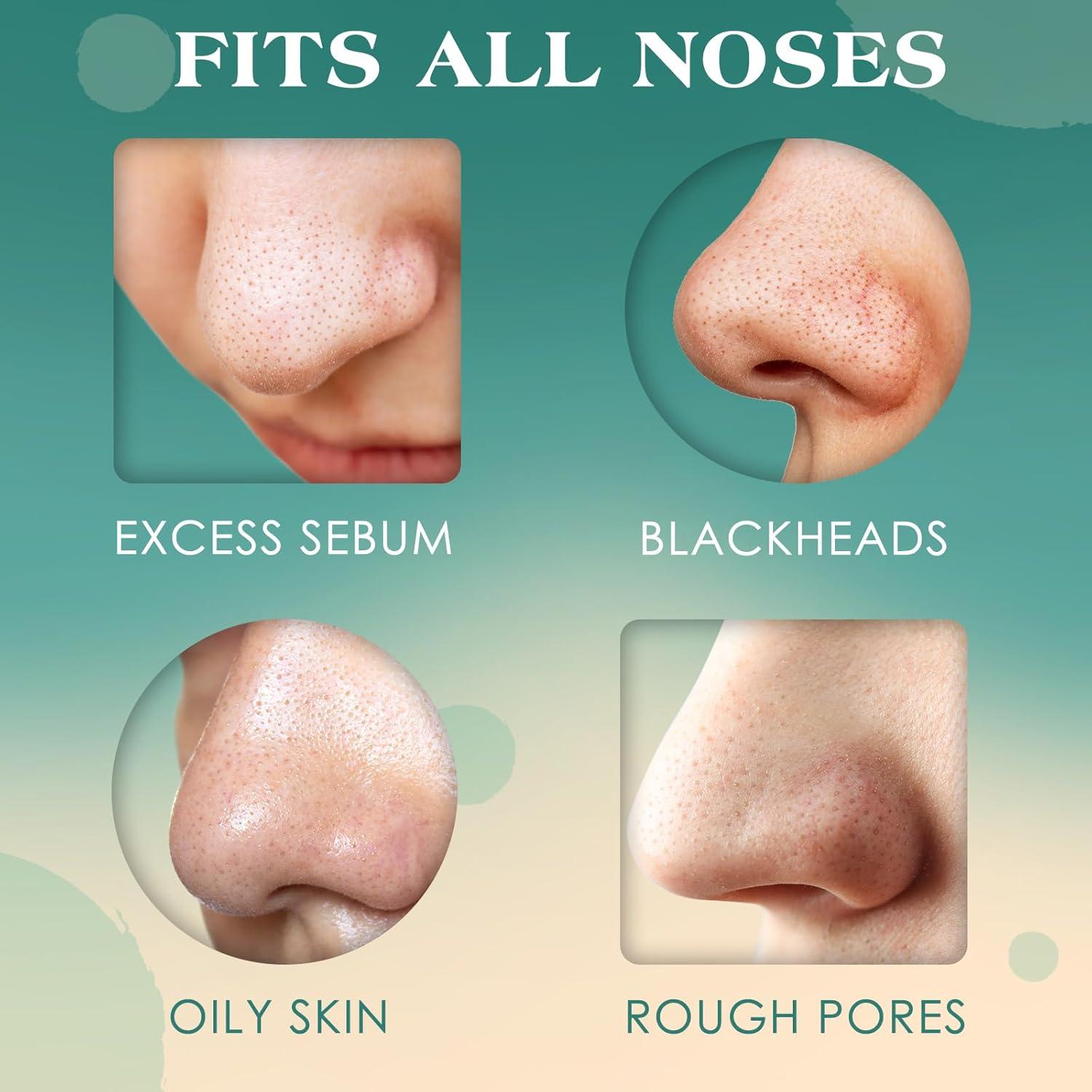 Tiras Nasales JOLVKA para Puntos Negros - 120 Tiras Carbón