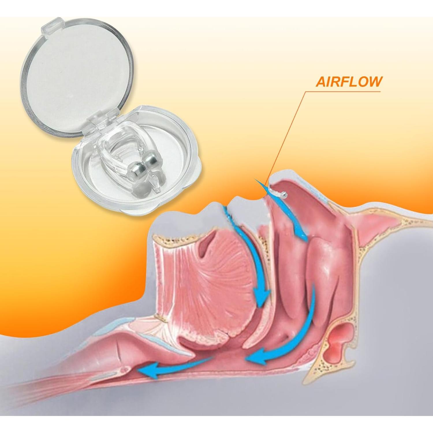 Dispositivos Antirronquidos Mobi Lock - Paquete de 30