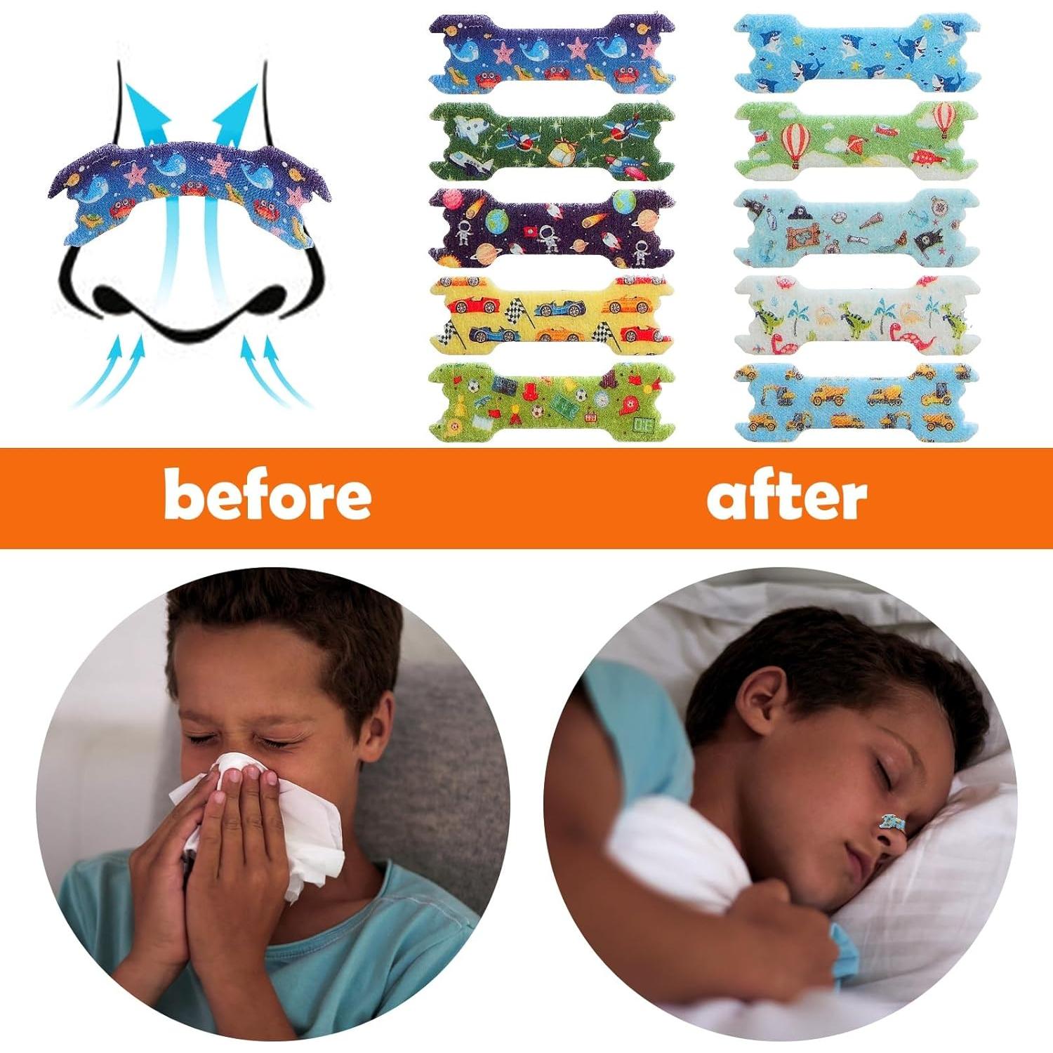 80 Tiras Nasales para Niños Stranthother 4,39x1,40 cm