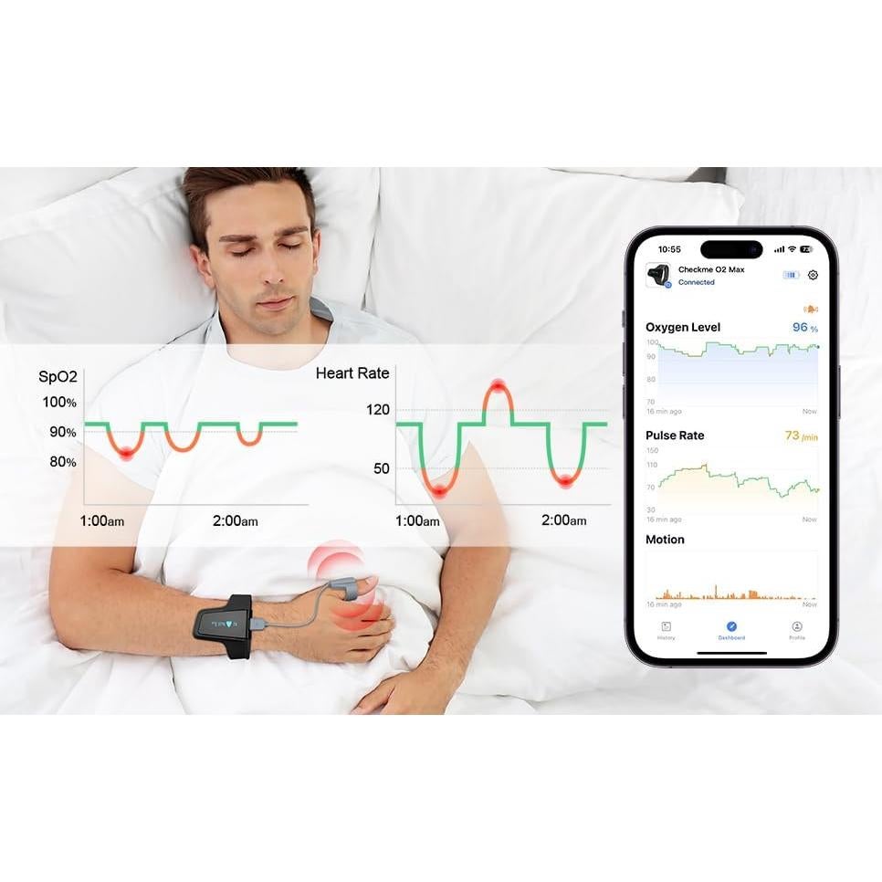 Oximetro de Pulso Wellue Oxiband con APP y Recordatorio