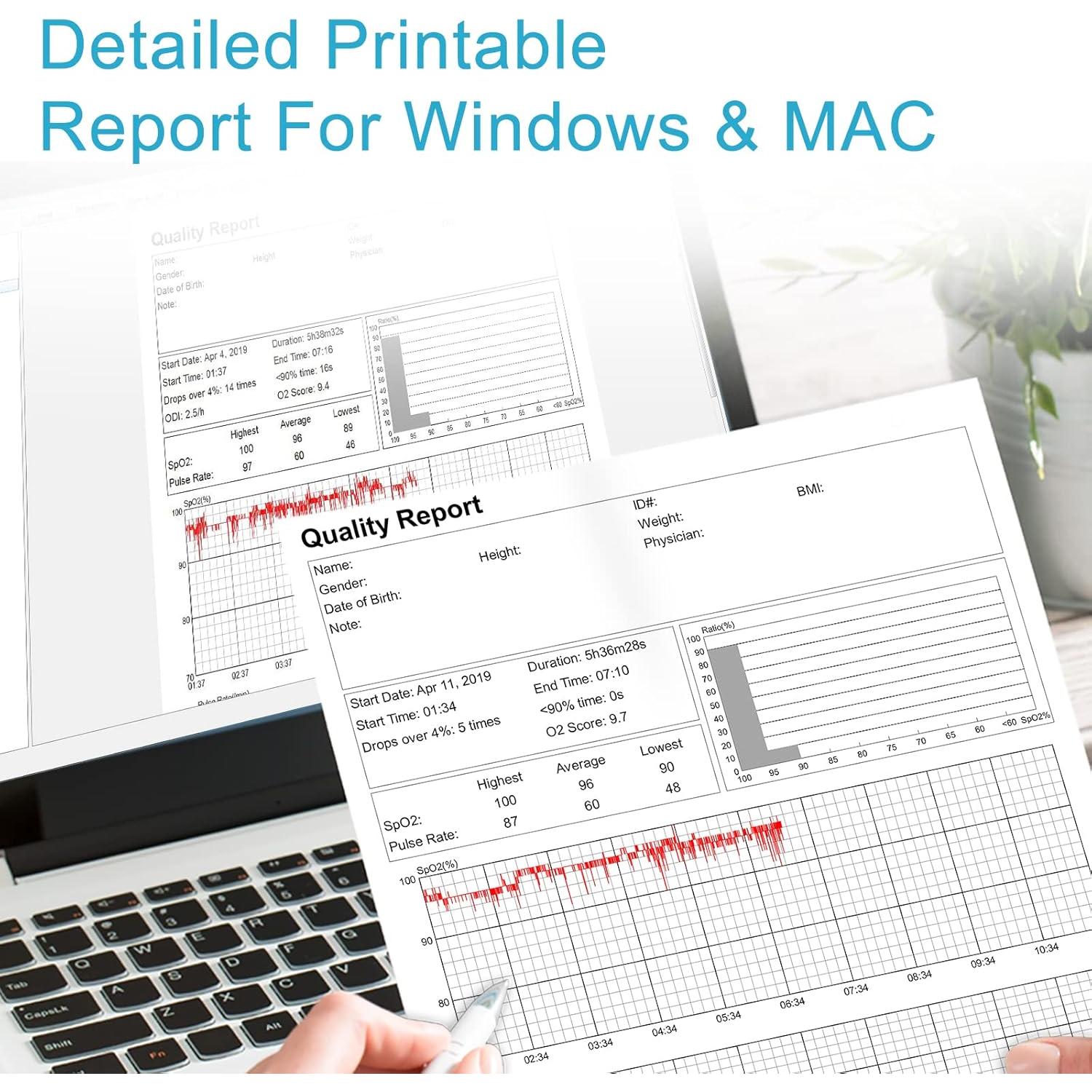 Oximetro de Pulso Wellue Oxiband con APP y Recordatorio