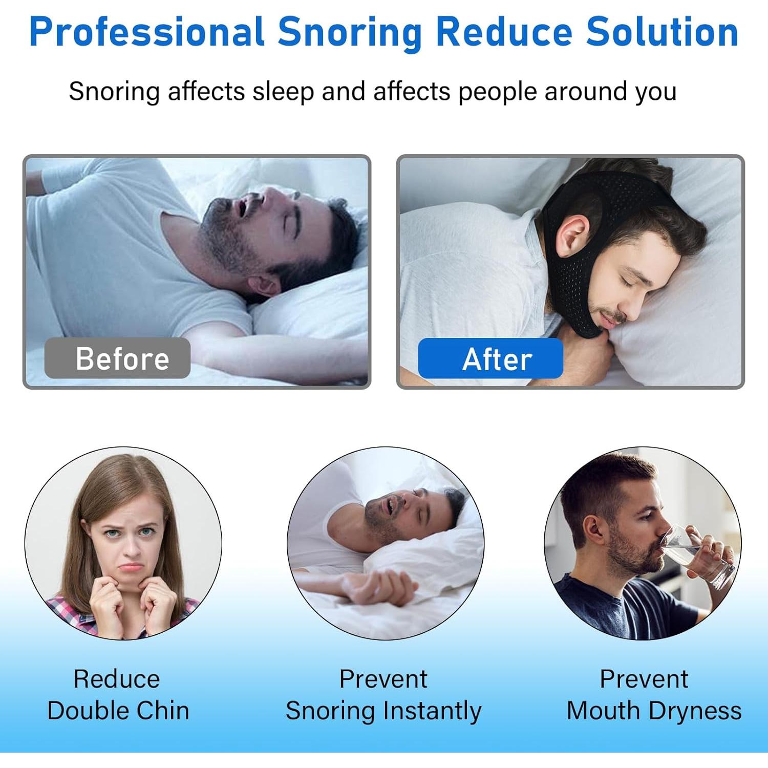 Correa de Barbilla Forzacx Antironquido Transpirable 2 Pzas