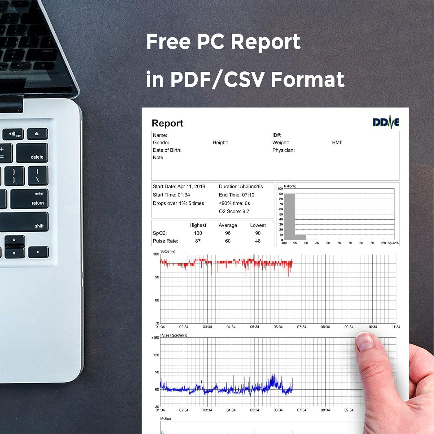 Oxímetro de Pulso Wellue O2Ring Bluetooth - Monitor de SpO2