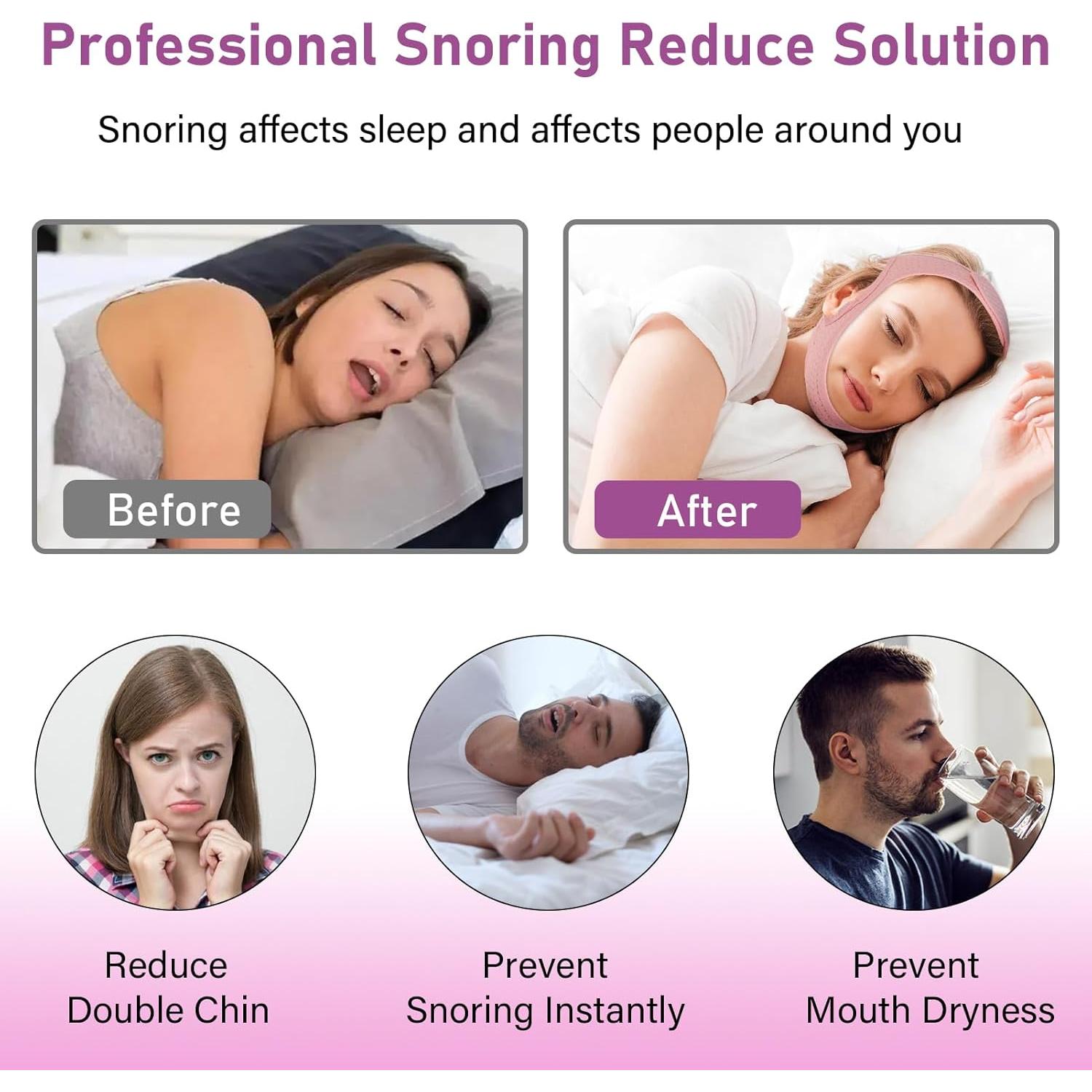 Correa de Barbilla Forzacx Antironquido Transpirable Rosa