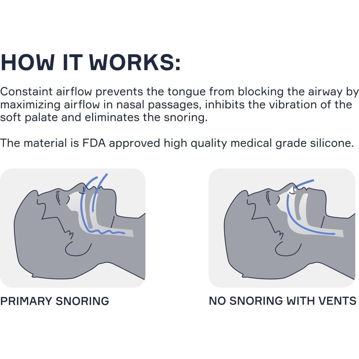 Dilatores Nasales Snore Bastion XL - 4 Conos de Silicona Suave