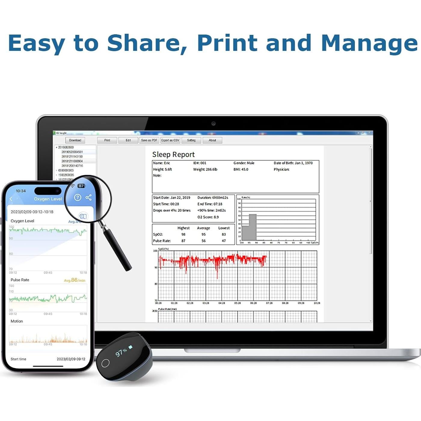 Monitor de Oxígeno Wellue O2Ring Bluetooth Recargable - Oximetro de Pulso con APP