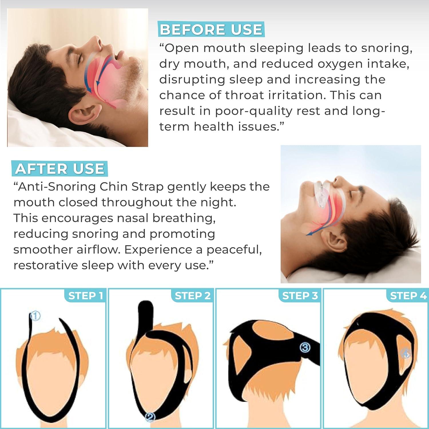 Correa de Barbilla Antironquidos Massner - Ajustable y Transpirable