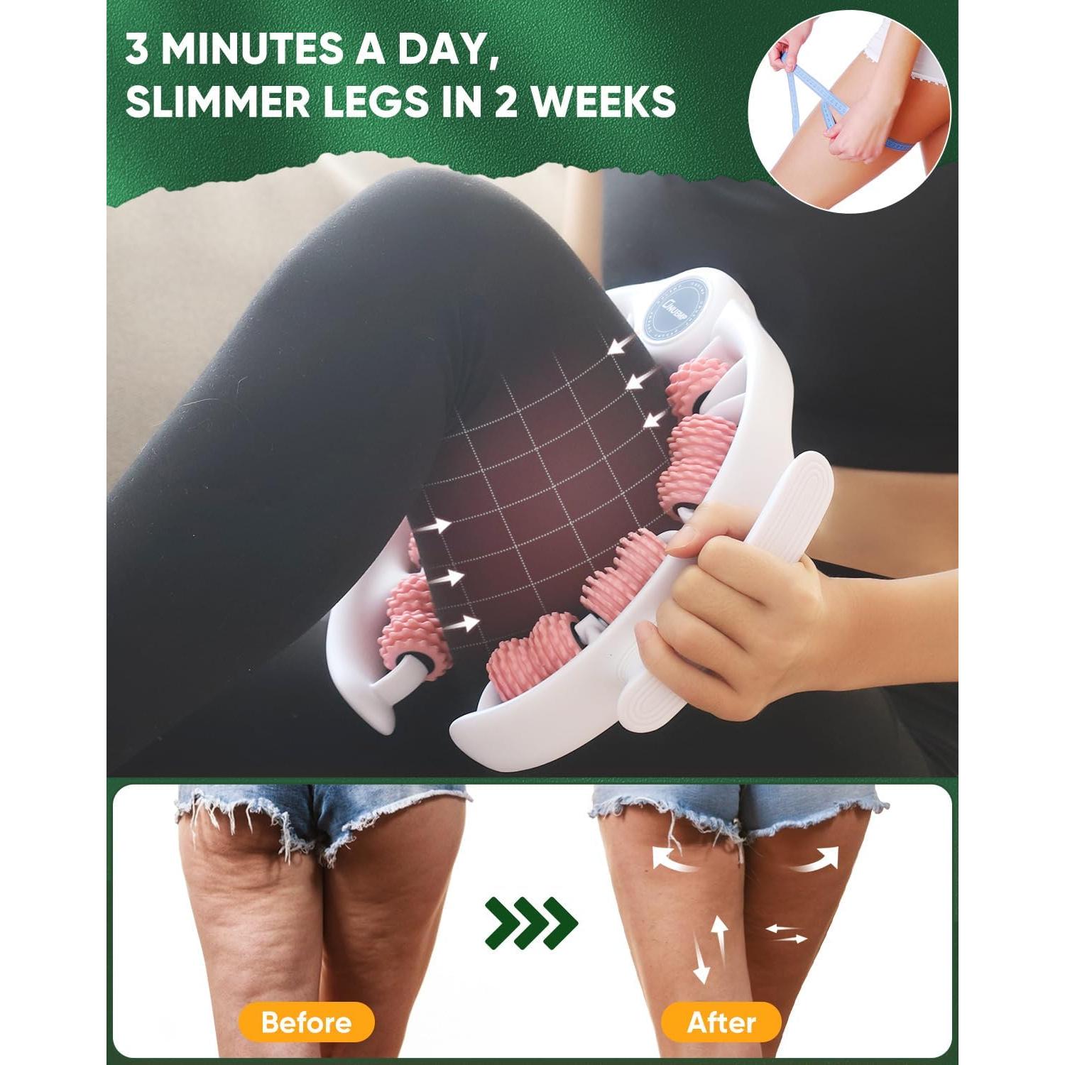 Rodillo Masajeador ONUEMP para Celulitis y Drenaje Linfático