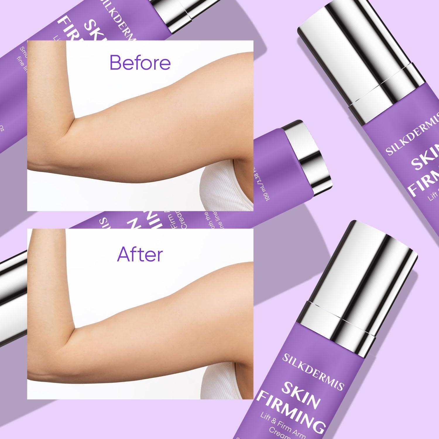 Crema Reafirmante SILKDERMIS para Piel Floja 200g