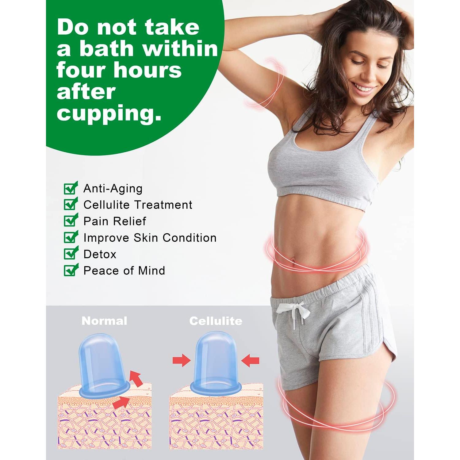 Kit de Ventosas de Silicona Shkiby - 6 Piezas Anticelulitis