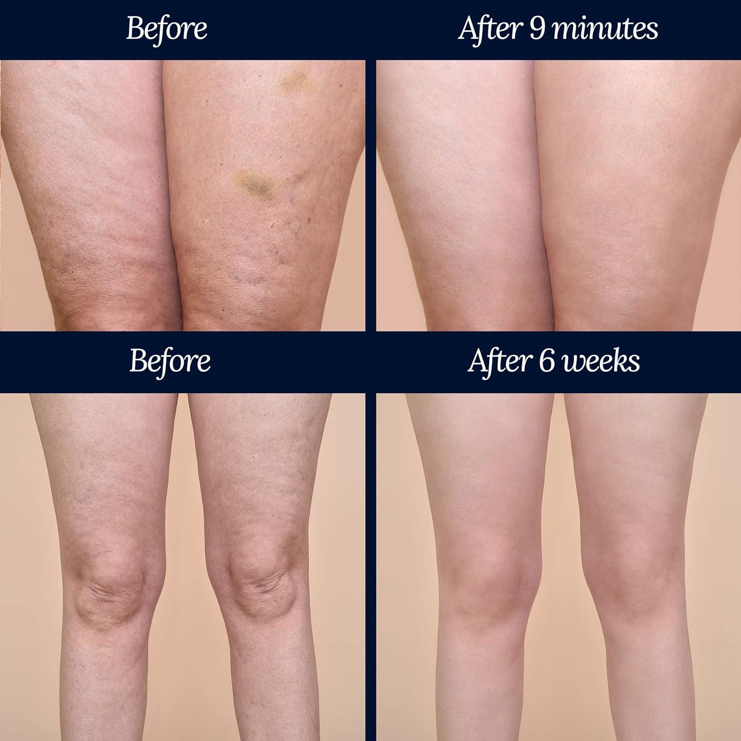 Crema Anticelulitis Adonia Legtone 100% Orgánica 200ml