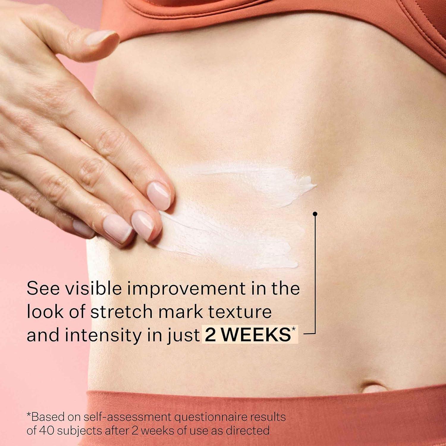 Hidratante Intensivo StriVectin para Arrugas y Estrías 60ml