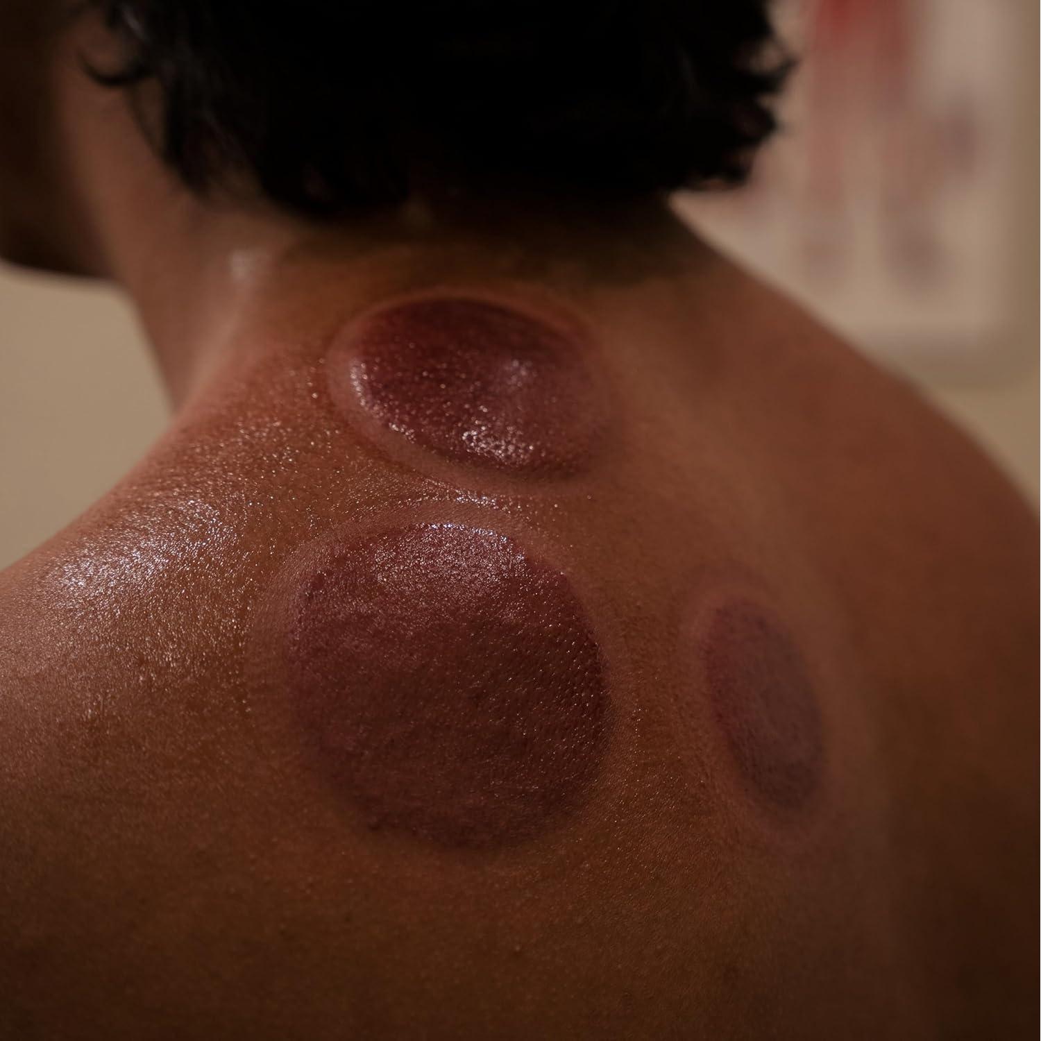 Juego de Ventosas Terapéuticas Myofascial Releaser - 18 Copas