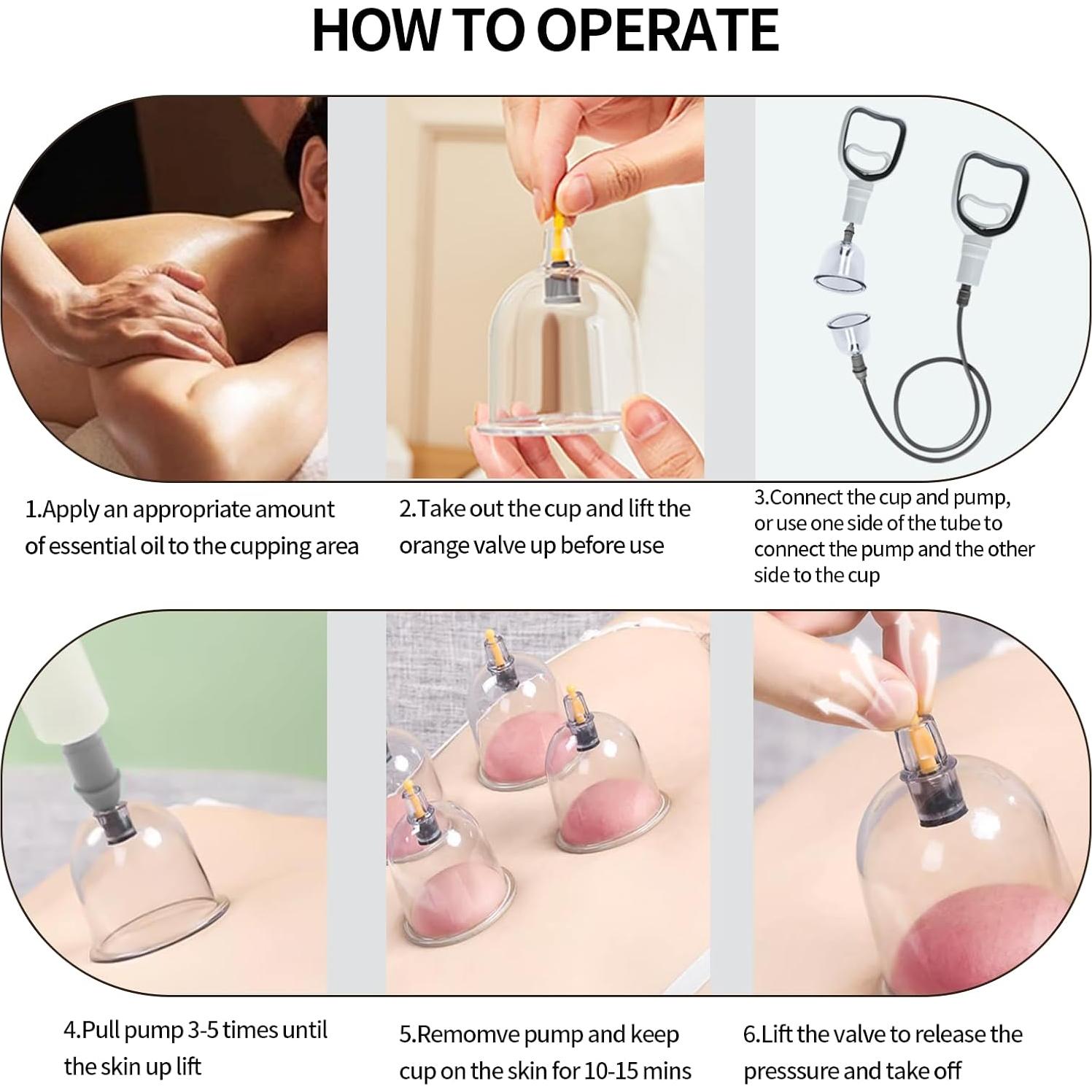 Kit de Ventosas Cupluw 24 Tazas para Masaje y Alivio Dolor