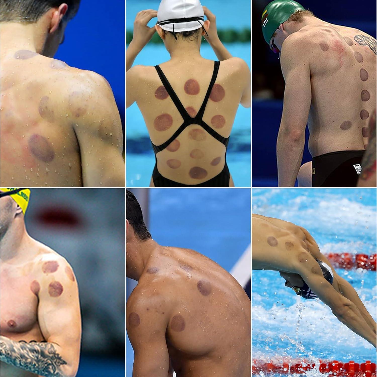 Kit de Ventosas Cupluw 24 Tazas para Masaje y Alivio Dolor