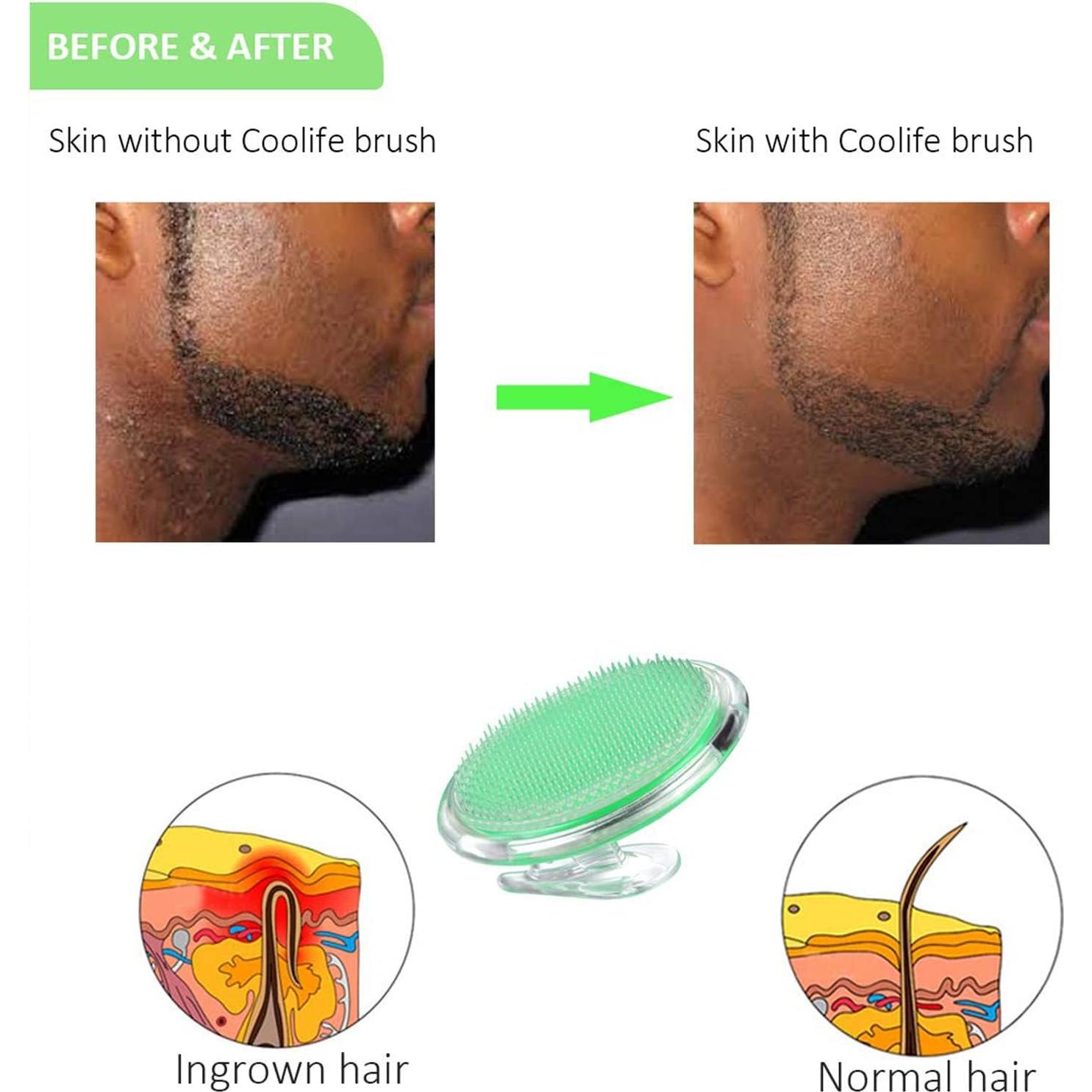 Removedor de Vello Encarnado Coolife C002 - Exfoliante Facial