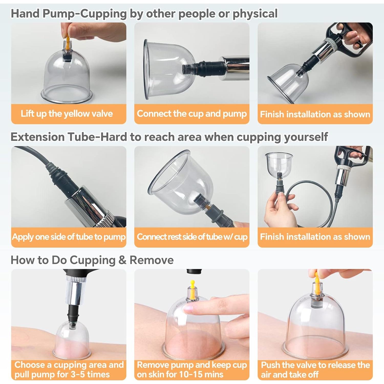 Juego de Ventosas AIKOTOO 24 Copas Masaje Terapéutico