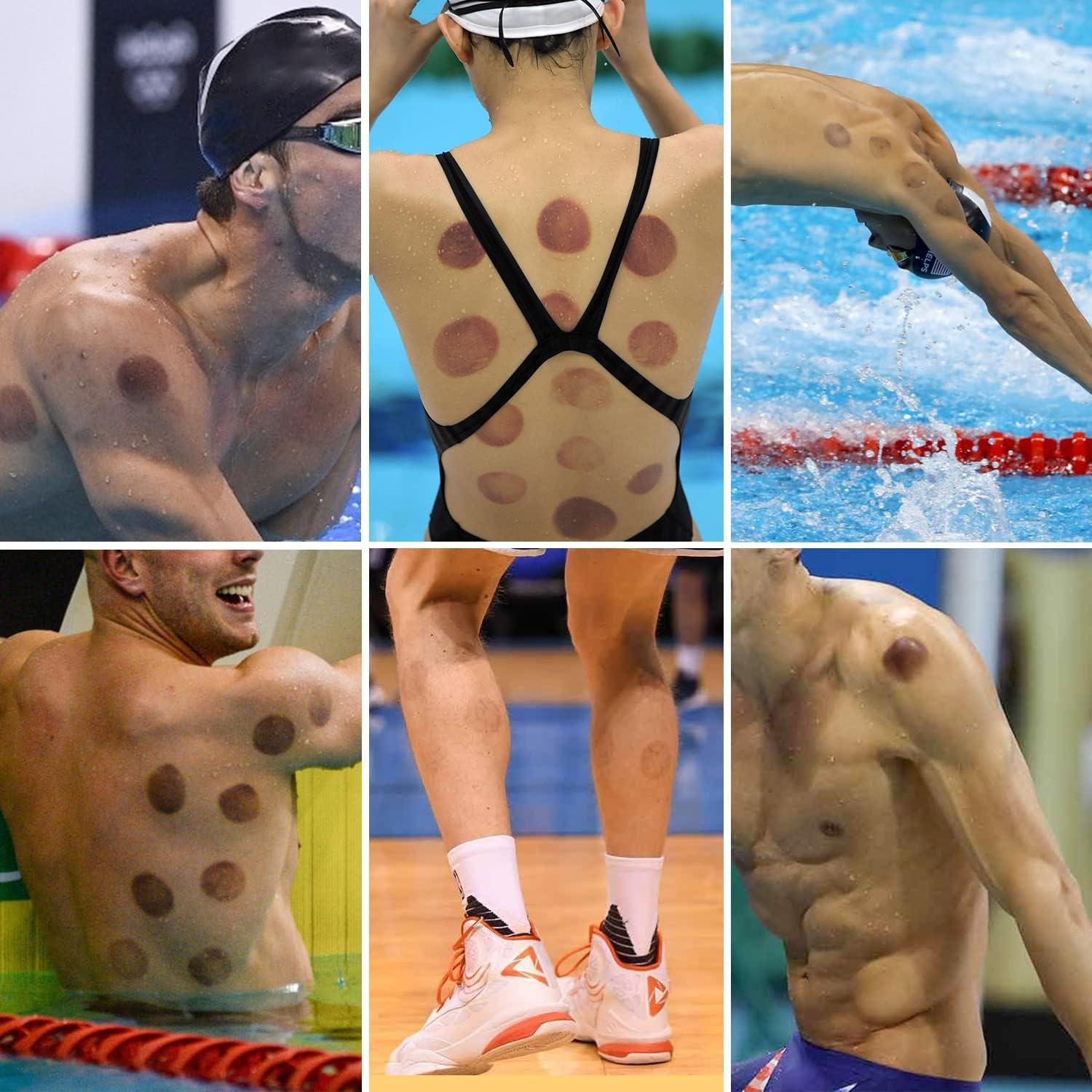 Juego de Ventosas AIKOTOO 24 Copas Masaje Terapéutico