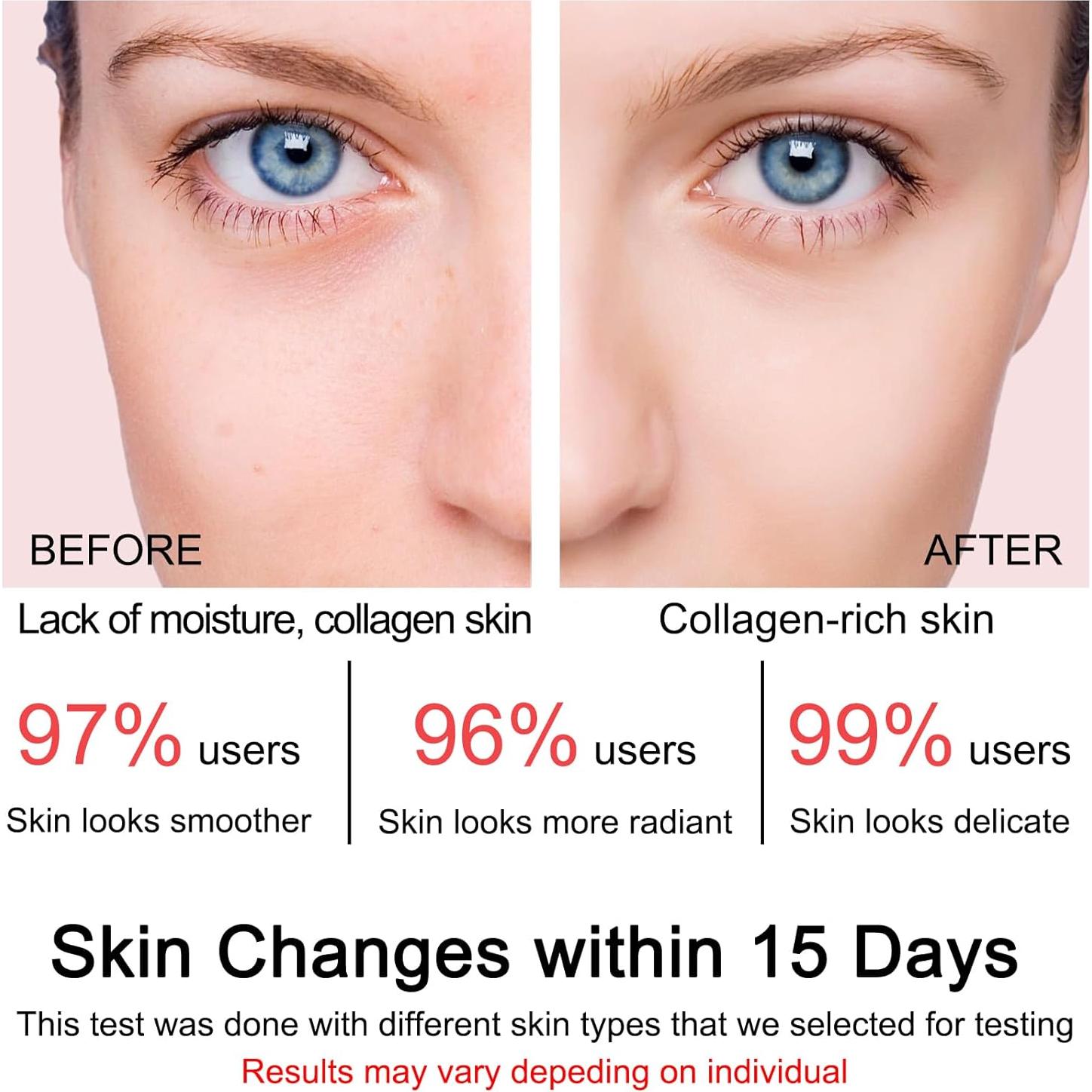 Crema de Gel de Colágeno SOYUB 100ml - Hidratante y Rejuvenecedora