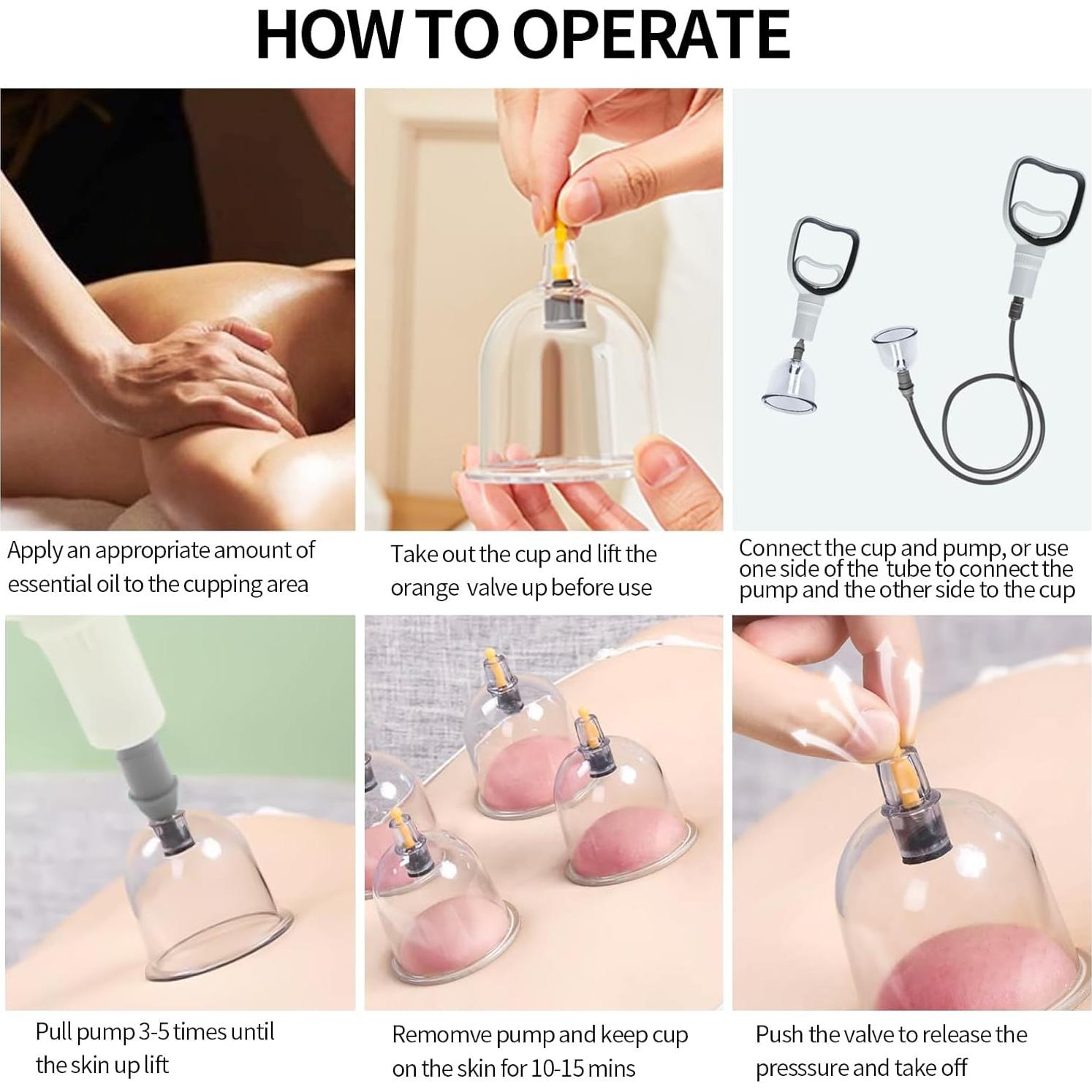 Kit de Ventosas Cupluw - 32 Copas para Masaje y Alivio