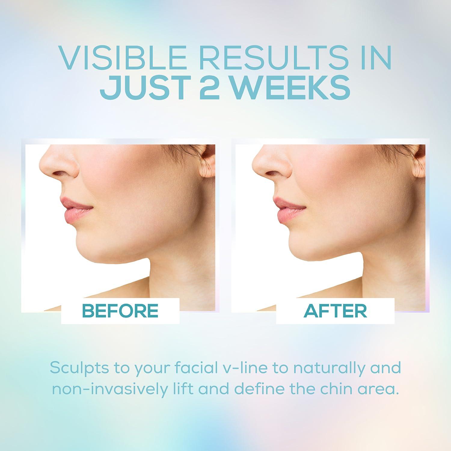 Correa de Levantamiento Facial Venus Visage para Mandíbula