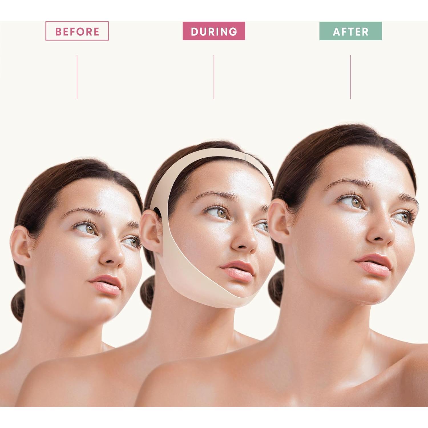 Máscara V de Elevación Facial Bayside para Doble Mentón