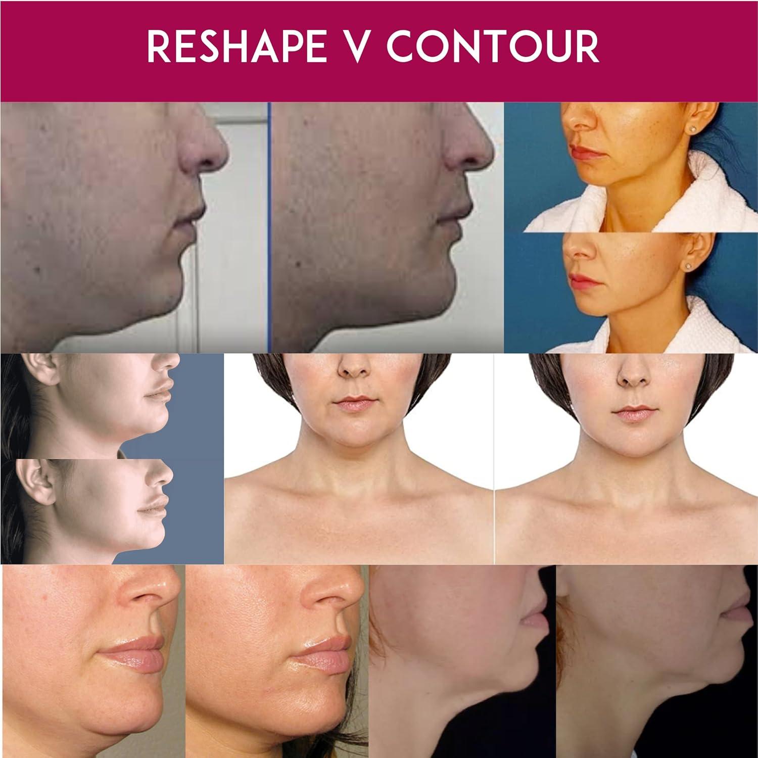 Crema Anti-Envejecimiento para Cuello Anacis 30 ml - Doble Barbilla