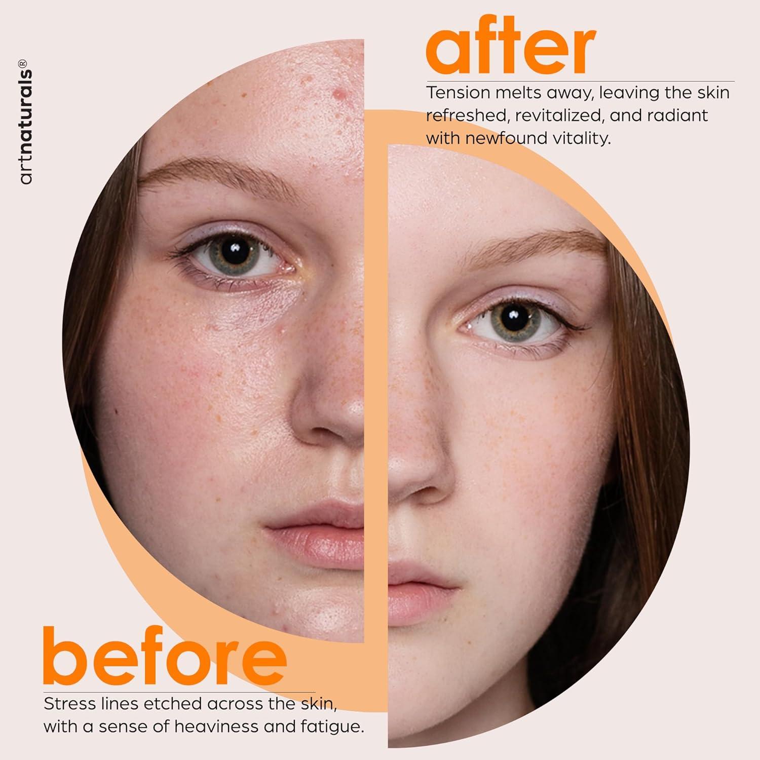 Aceite Bio de Vitamina E ArtNaturals 248ml + Set Gua Sha