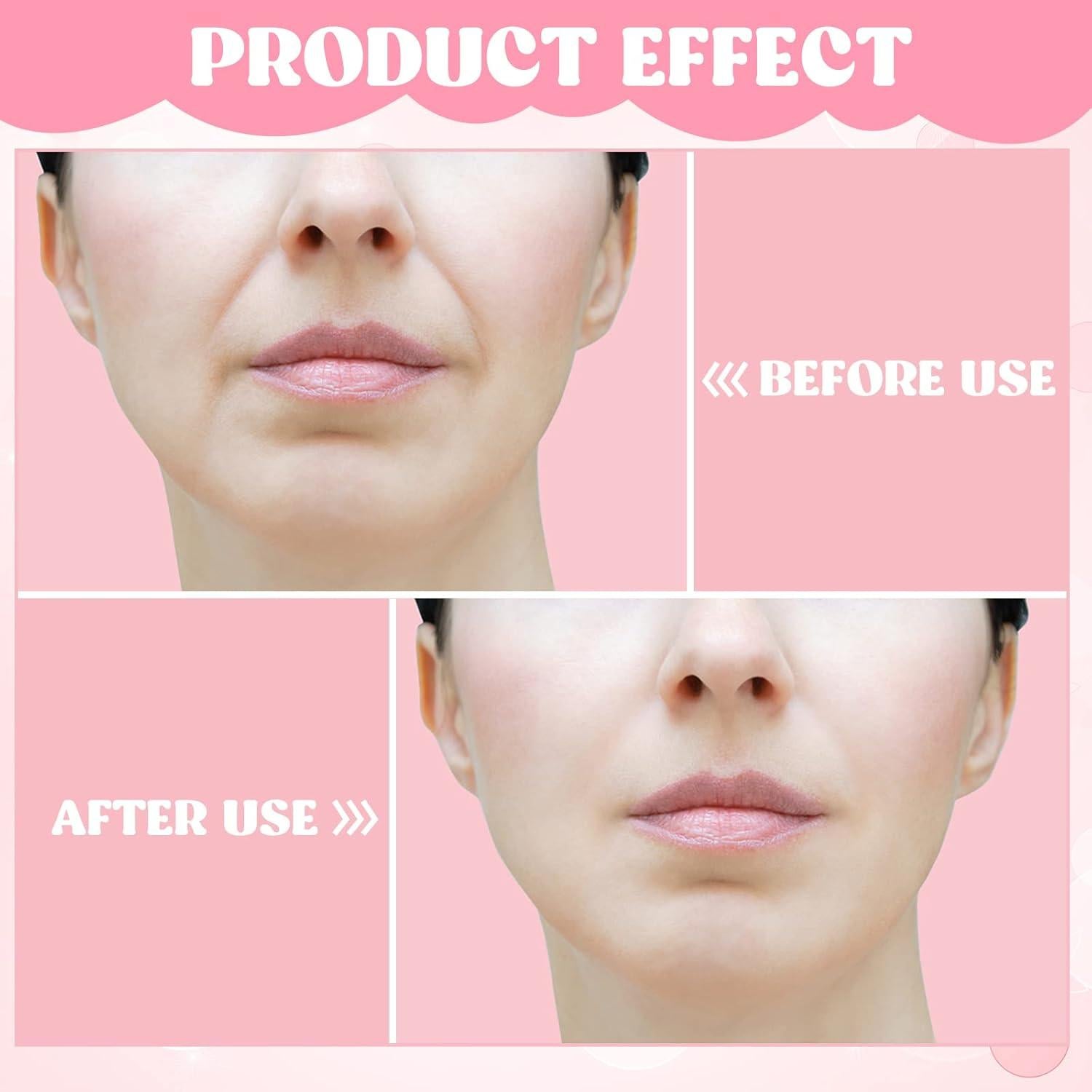 Paquete de 3 Ejercitadores Faciales Demissle para Tonificar