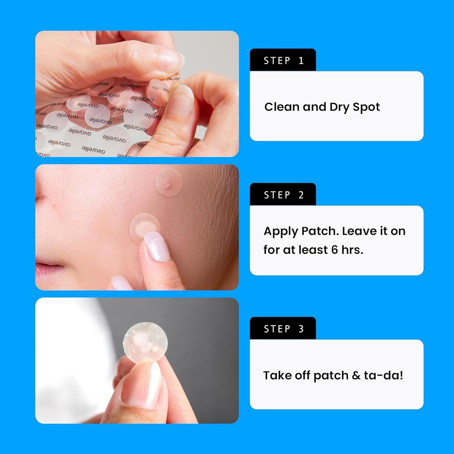 Parches para Acné Avarelle 40 Unidades Hidrocoloides