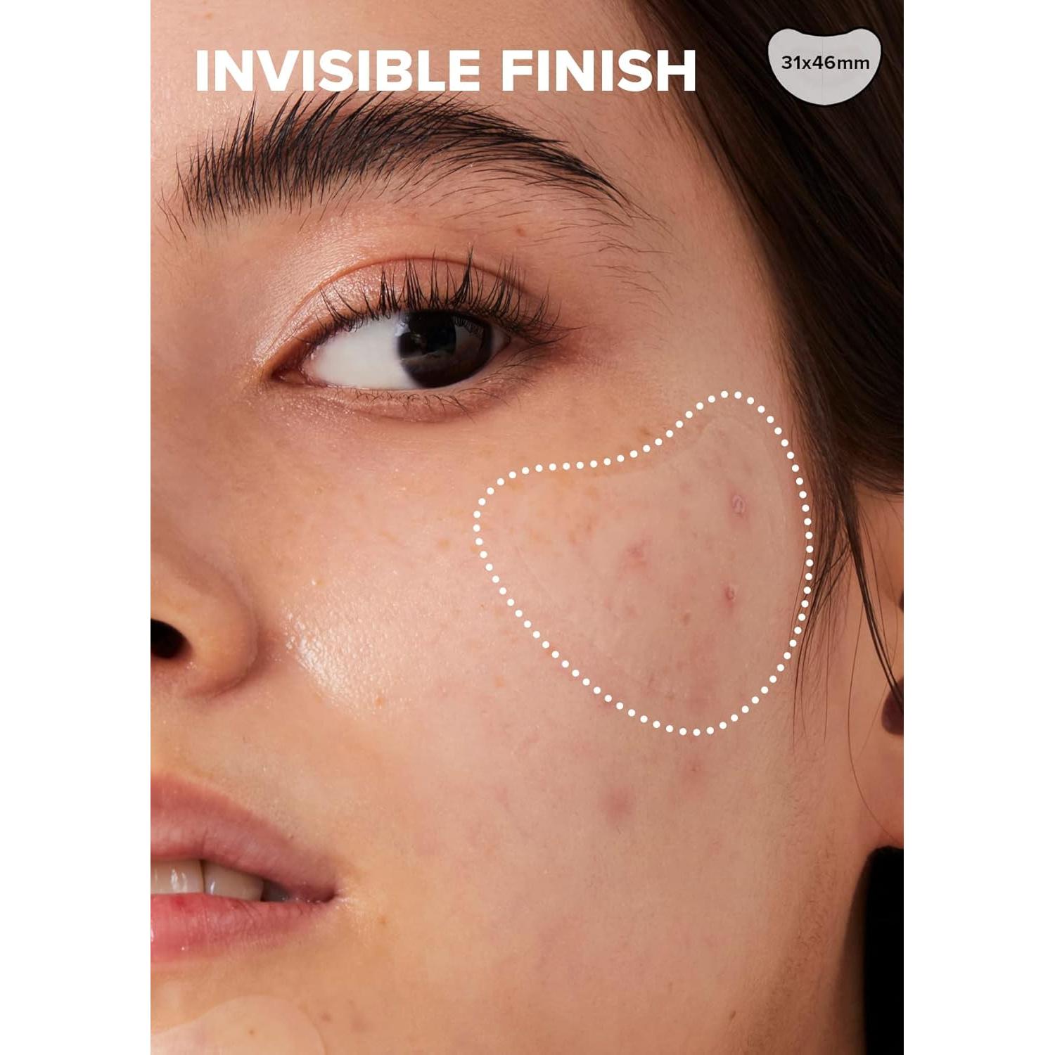 I DEW CARE Parche Hidrocoloide Acné 9 Unidades Barbilla