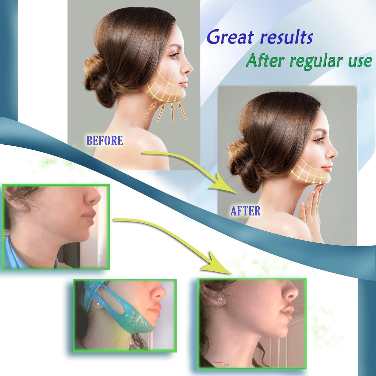 Correa Facial Reutilizable BYONDO para Doble Papada - TPE Suave