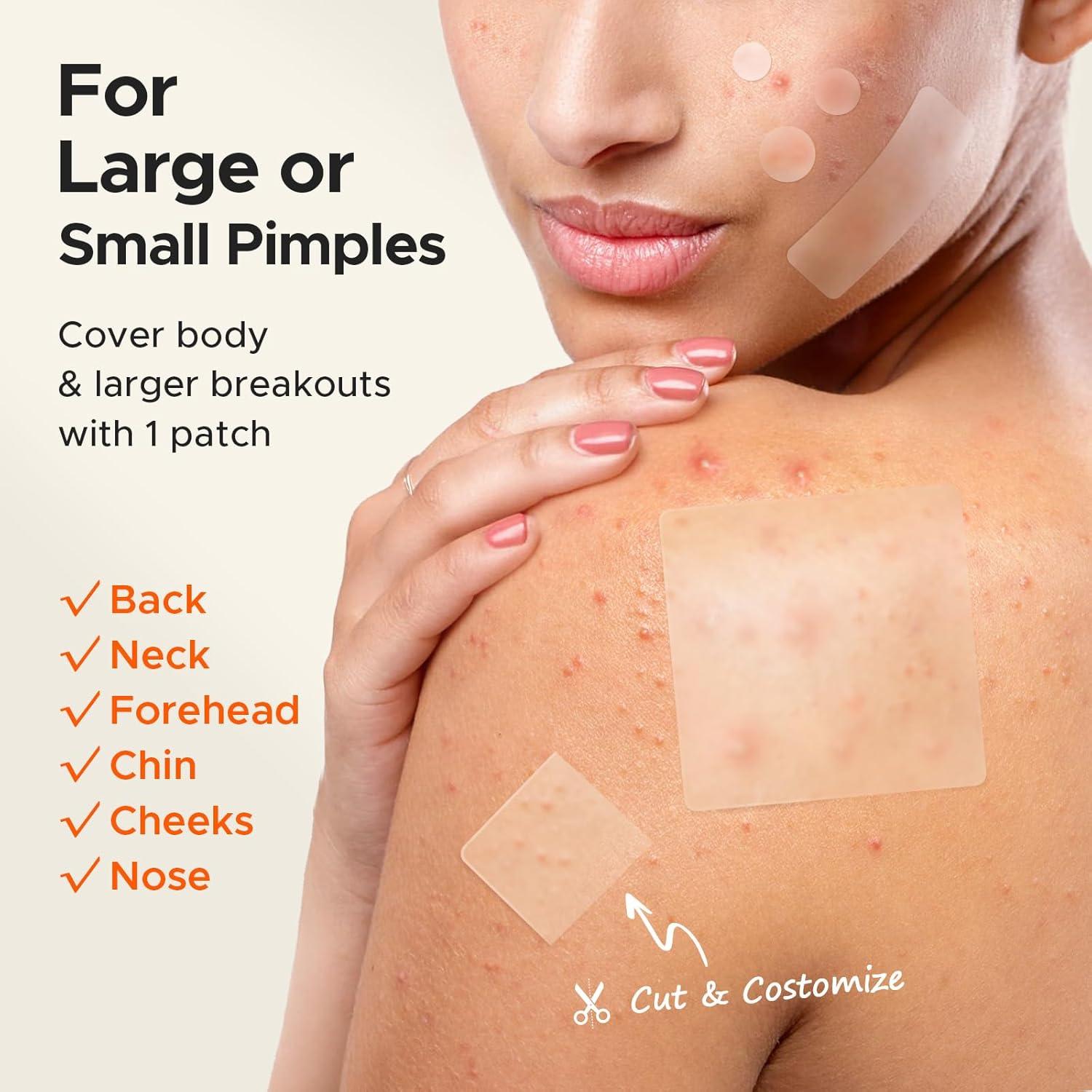 Parche Hidrocoloide XL TKTK 60 mm para Granos y Acné